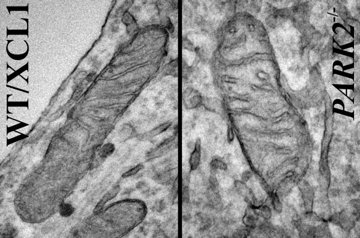 Mitochondria Mutation Linked To Human Parkinson's Disease For First Time