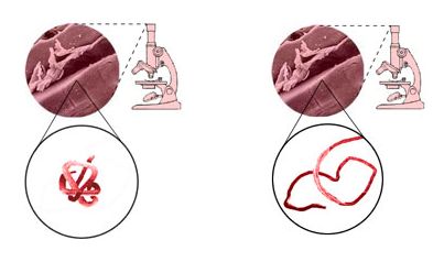 https://www.science20.com/files/images/beef%20muscle%20fibers%20before%20and%20after%20cooking.JPG