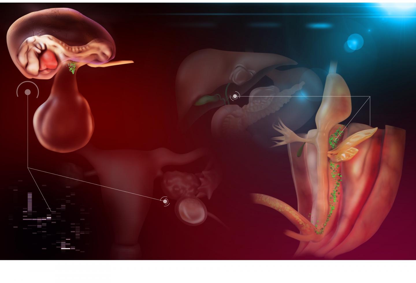 The Pancreas Has Little Exposure To Sex Hormones So Why Do Women Get One Form Of Its Cancer?