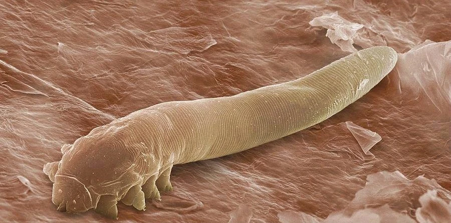 demodex_folliculorum