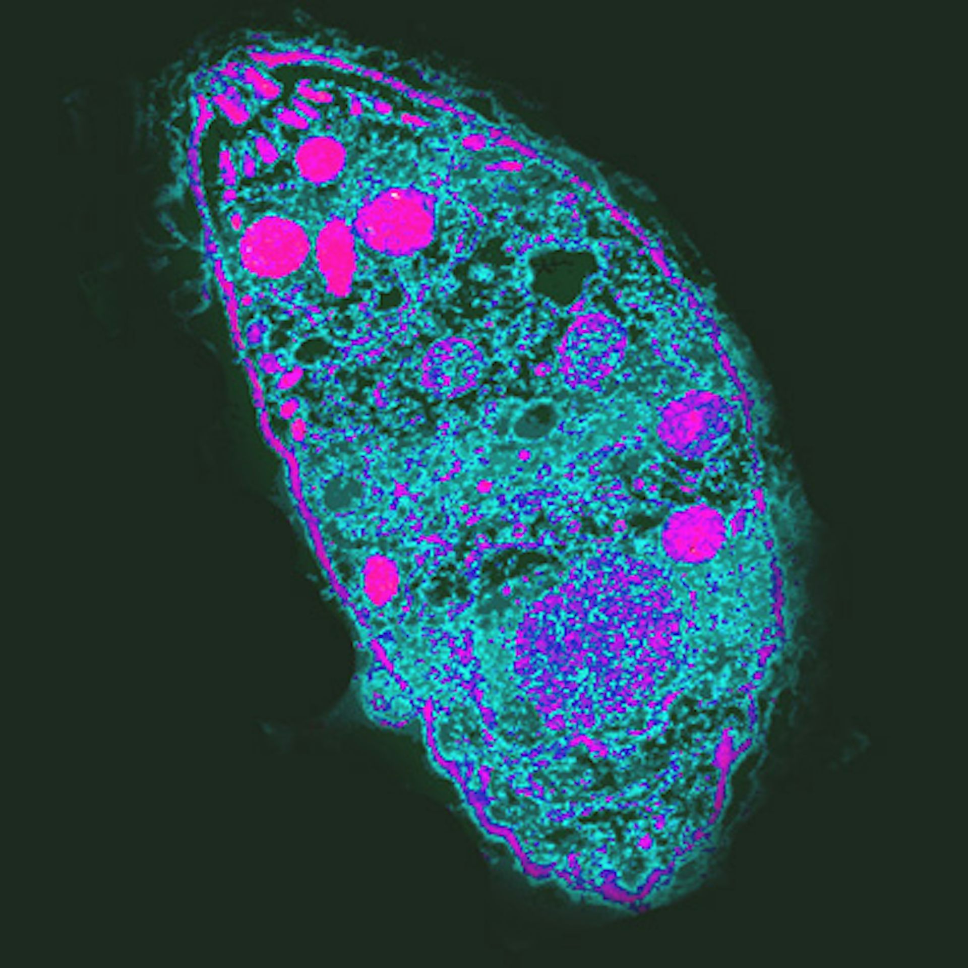 toxoplasma_gondii