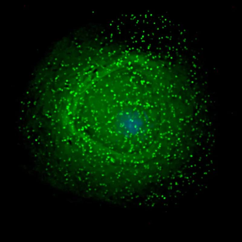 HIV_on_macrophage
