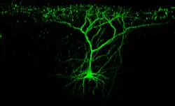two-photon microscope image of a layer nerve cell in the visual cortex of a mouse