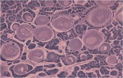 intersex gonads fish estrogen rivers