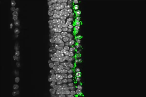 Cross section of a degenerated Retinitis pigmentosa retina Cross section of a degenerated Retinitis pigmentosa retina