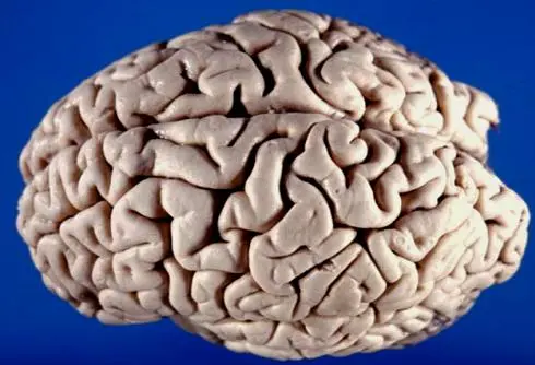 A superior-lateral view of the brain. Photo by John A Beal, PhD Dep't. of Cellular Biology&Anatomy, Louisiana State University Health Sciences Center Shreveport. Some rights reserved. A superior-lateral view of the brain. Photo by John A Beal, PhD Dep't. of Cellular Biology&Anatomy, Louisiana State University Health Sciences Center Shreveport. Some rights reserved.
