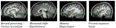 Brain Circuit Nodes Teen Anticipation