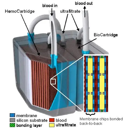 implantable bioartificial kidney implantable bioartificial kidney