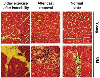muscle regeneration aging muscle regeneration aging