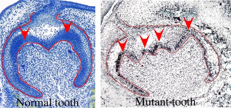 healthy and deformed molar with the Jagged2-gene deactivated in the mouse embryo healthy and deformed molar with the Jagged2-gene deactivated in the mouse embryo