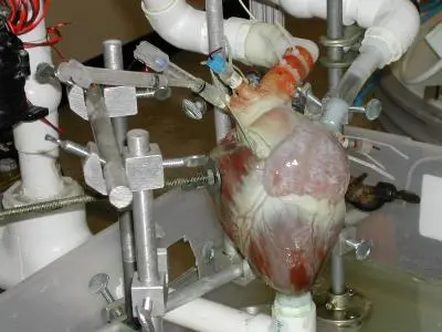 dynamic heart system dynamic heart system
