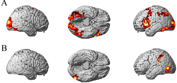 Identified: Locations Of Thought Processes For Familiar Objects ...