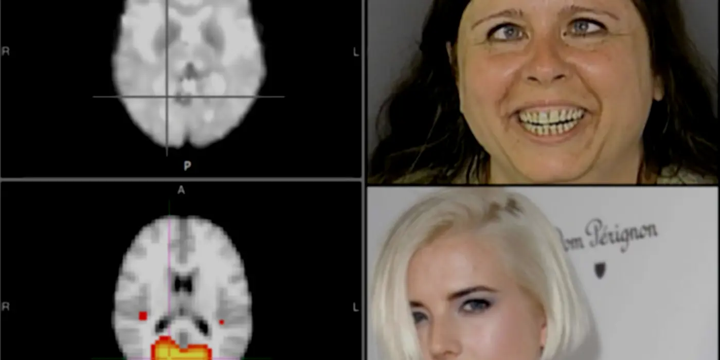FMRI Study Finds That Mindfulness More Effective Than Scientology At Clearing Thetans