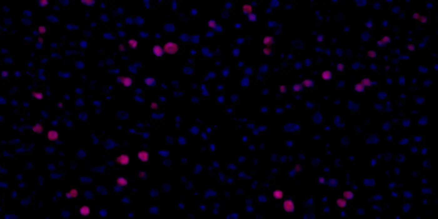 hepatocytes_dividing_during_the_liver_regeneration_process_after_hmb_supplementation