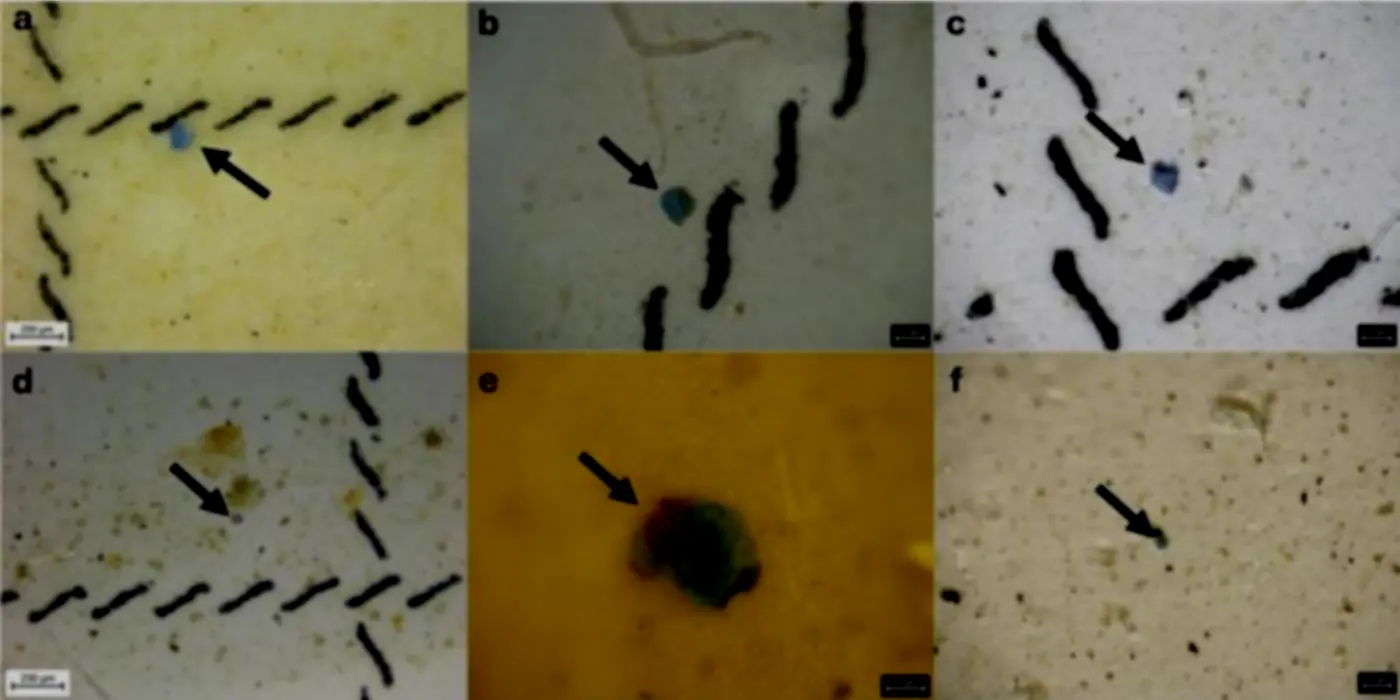 Epidemiology: Microplastics Cause Lung Cancer