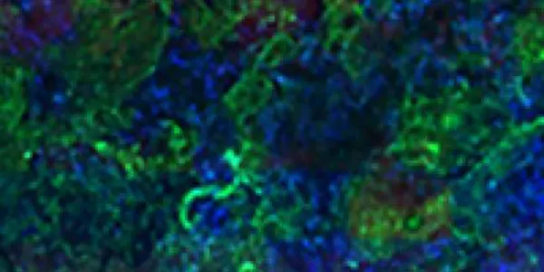 Engineers Design Artificial Bones That Naturally 'Blend' Into Tendons