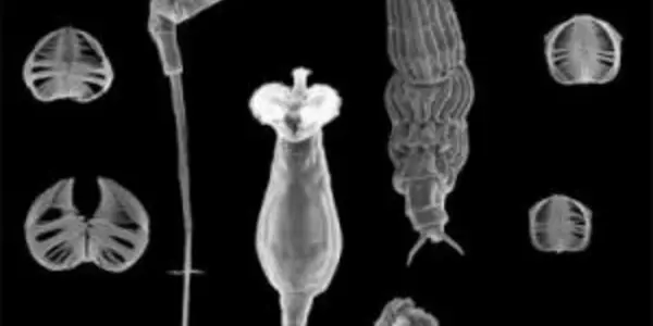 Free Radicals And Aging Discovery - This Aquatic Animal Is Resistant To Radiation
