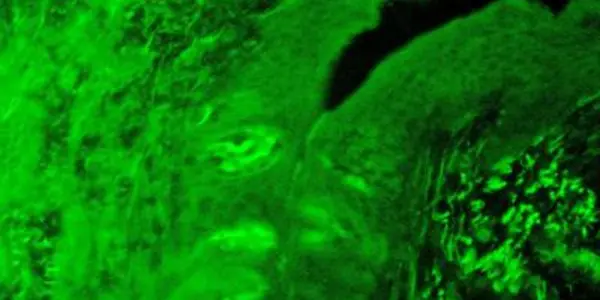 Mice Have Six Taste Buds Instead Of Five (And Maybe We Do Too)