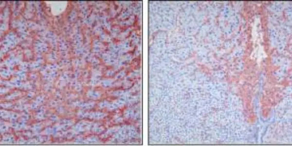 Cx43 - Successful Pregnancy And Gap Junction Protein Linked