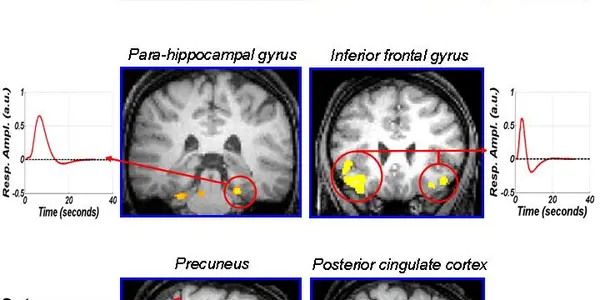 Even When You Sleep, Your Brain Is Awake