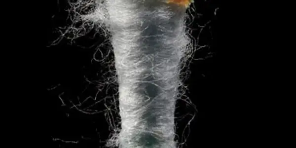 Everyone take a big sigh of relief: national guidelines for earwax removal have just been released