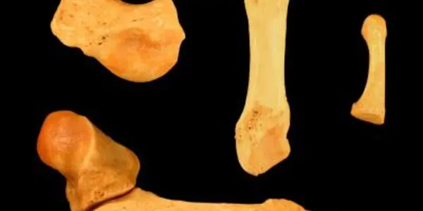 Mysteries Linger Over Lemur's Little Finger