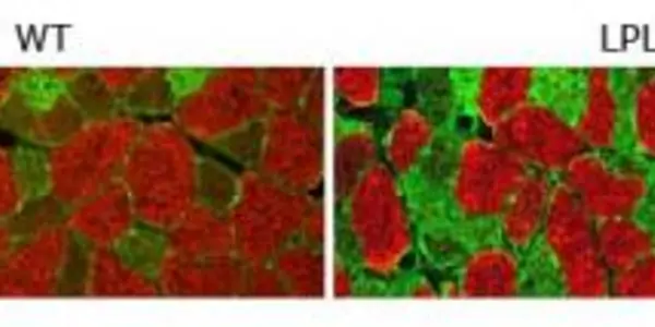 LPL Overexpression Reconfigures Muscle To Use Fat For Energy