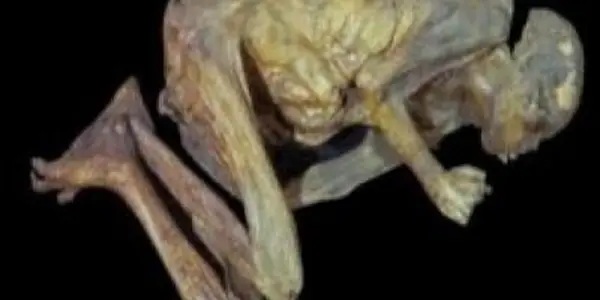Ulcer Bacterium Found In 700 Year-Old Mexican Mummy