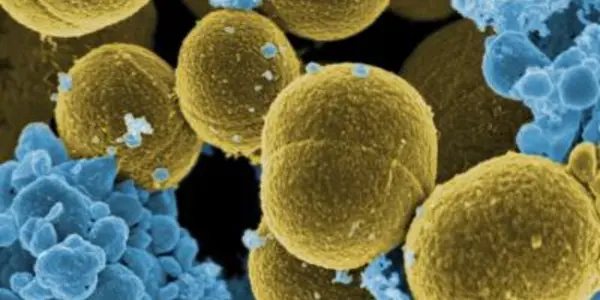 Tracing The Evolution Of The CA-MRSA 'Superbug'