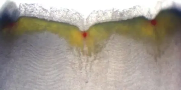 How Do Animal Bodies Know How Many Appendages To Grow Back?