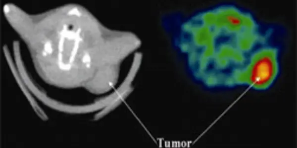 New Weapon Against Cancer: HIV Protein Enlisted To Help Kill Cancer Cells