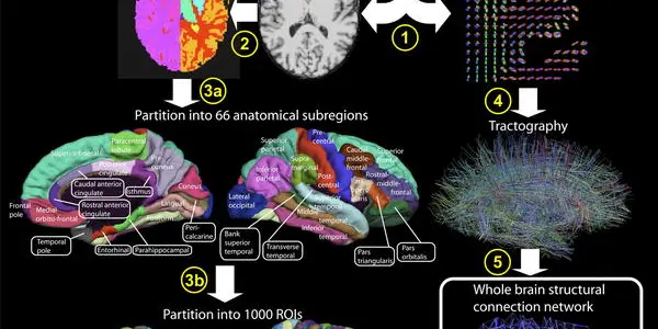 Cerebral Cortex And Its Millions Of Neural Fibers Gets A Map