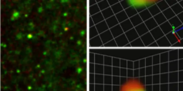 Visualizing Memory - Scientists See Changes In Brain Cell Connections