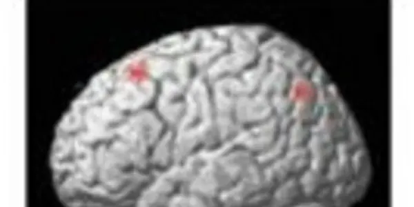 Neuro-Education And Rewiring The Dyslexic Brain