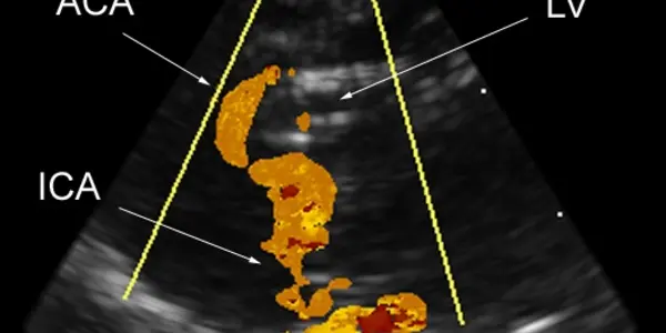 The Brain Scope - Seeing The Brain In 3-D