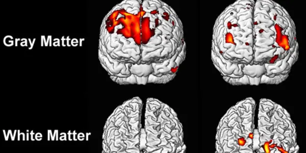Sex on the brain - how men and women differ