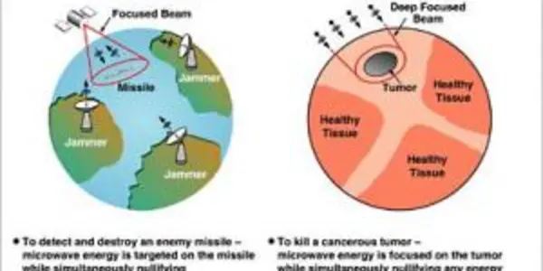 If It Can't Detect Missiles, Let's Use It To Detect Breast Cancer