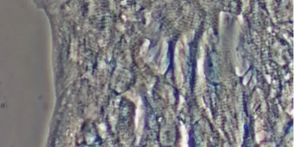 Breakthrough: Two Obstacles To Stem Cell Heart Repair Overcome