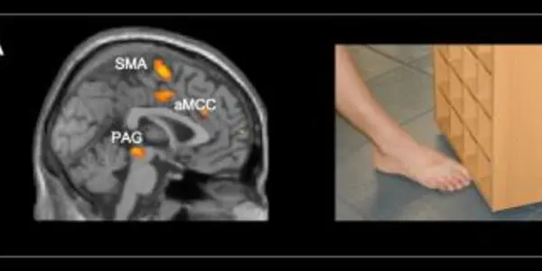 FMRIs In Kids Show Kindness Is Naturally In The Brain