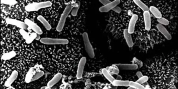 The Self-Assembling Armor Of The Clostridium Superbug