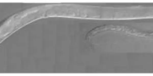 Constipated Worms Release Details Of How Protons Help Digestion