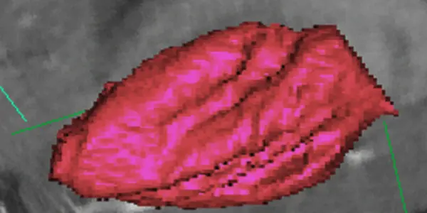 'Virtual' mouse brains now available online