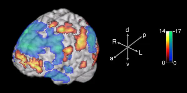 Study: Prefrontal Cortex In Jazz Musicians Winds Down When Improvising