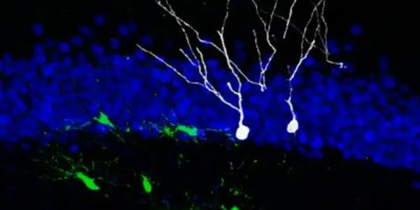 Neural Stem Cells Reprogrammed - While Still In The Brain!