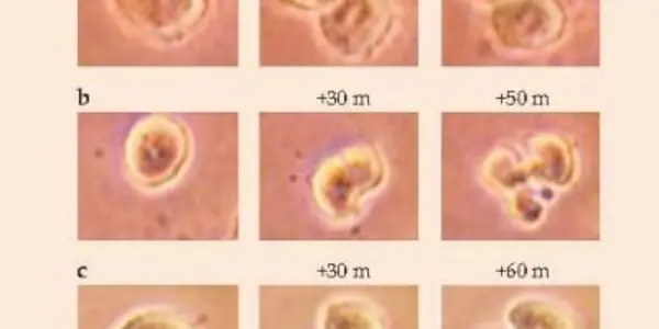 Electric Fields As Cancer Treatment