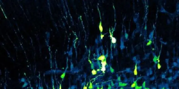 Slow Stem Cell Division May Cause Small Brains