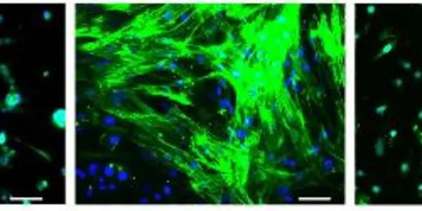 Fighting Liver Fibrosis, The Wound That Never Heals