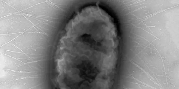 Pandemic E. Coli Strain H30 Cloaks Its Stealth Strategies