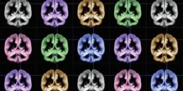 The Search For Happiness: Using MRI To Find Where Happiness Happens