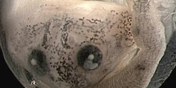 How Digestive Organs Evolved: A Cannibal Tadpole Tale